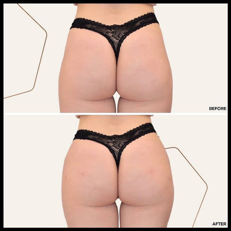 118887925_611641969523069_2803073568081538436_n