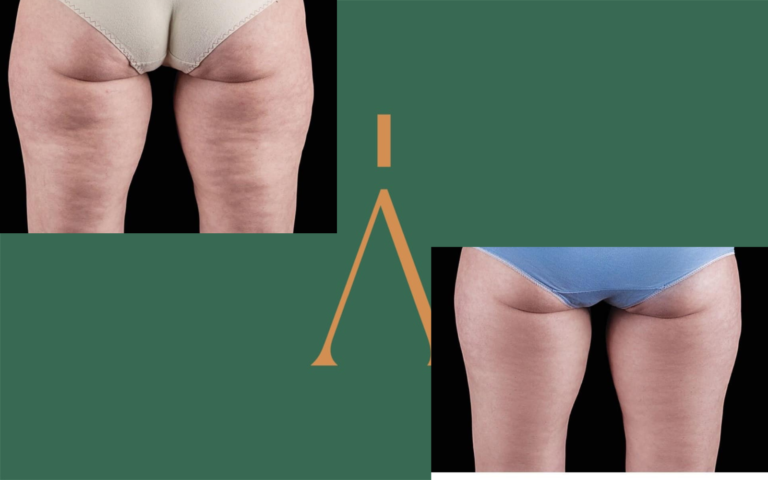 Progetto senza titolo (12) (1)