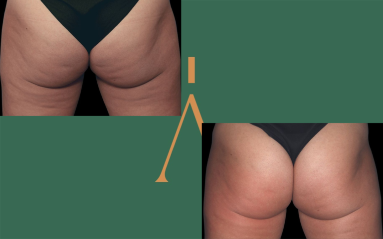 Progetto senza titolo (13) (1)