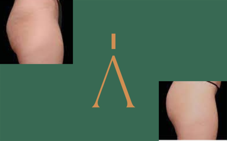 Progetto senza titolo (14) (1)