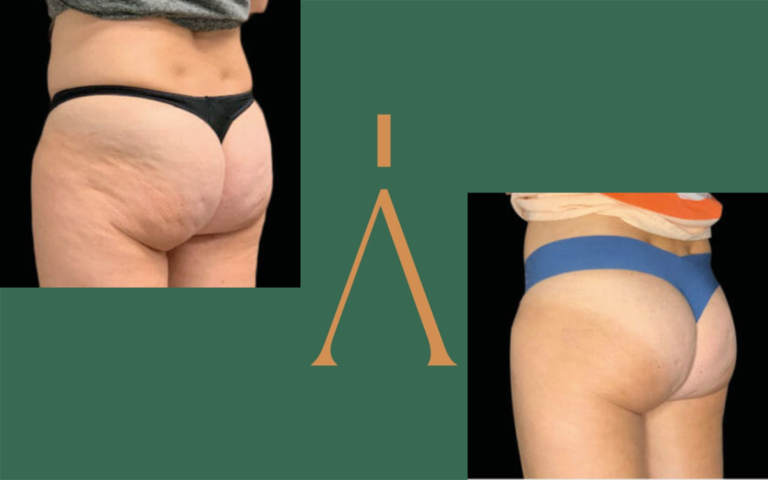 Progetto senza titolo (15) (1)