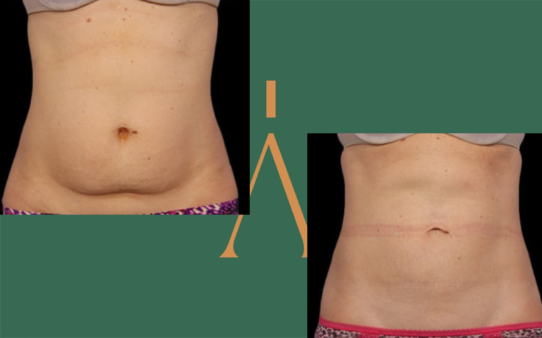 Progetto senza titolo (2) (1)