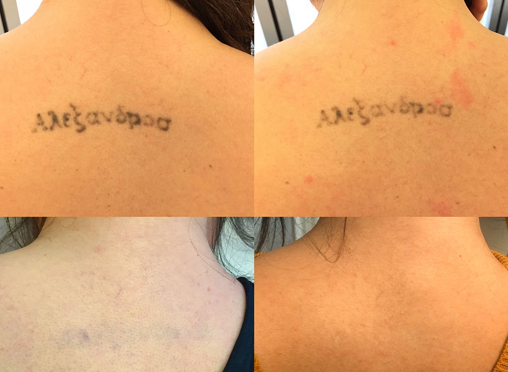 Josh_Updated-e1665639858455