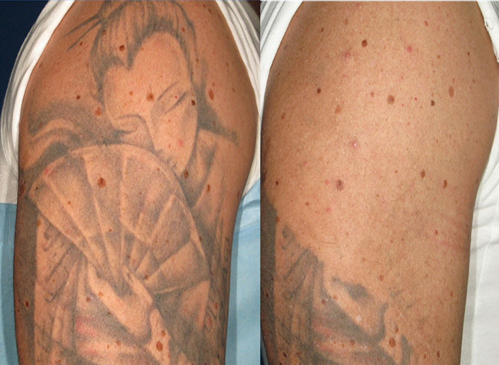 Josh_Updated-e1665639858455