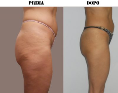 biodermogensi6-e1552474635170