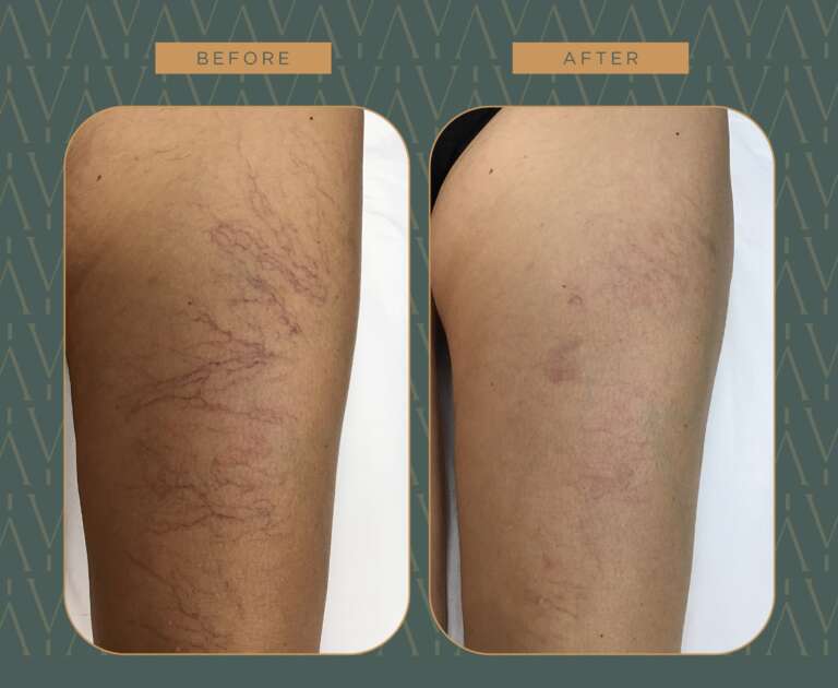 photo_5882179770727384227_w