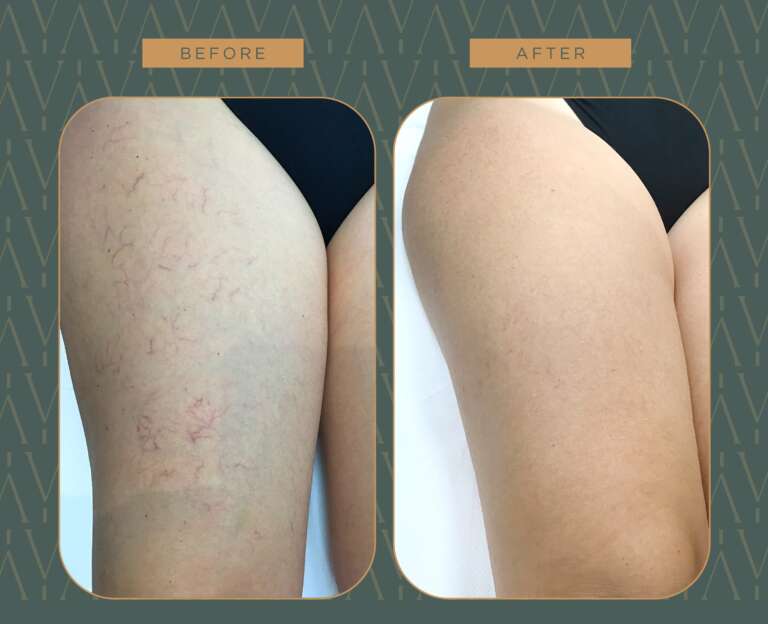 photo_5882179770727384228_w