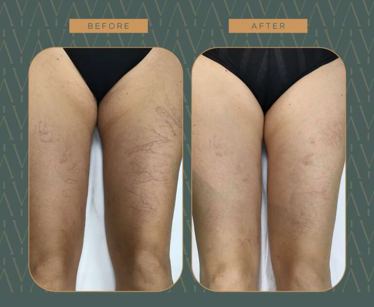 photo_5882179770727384229_w