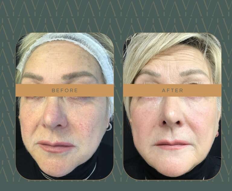 photo_5922343646294819535_y