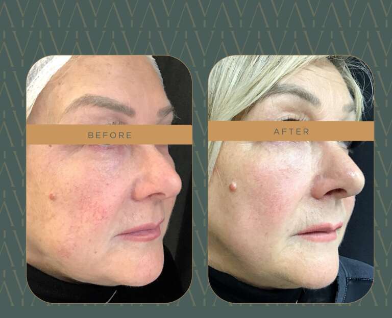 photo_5922343646294819536_y