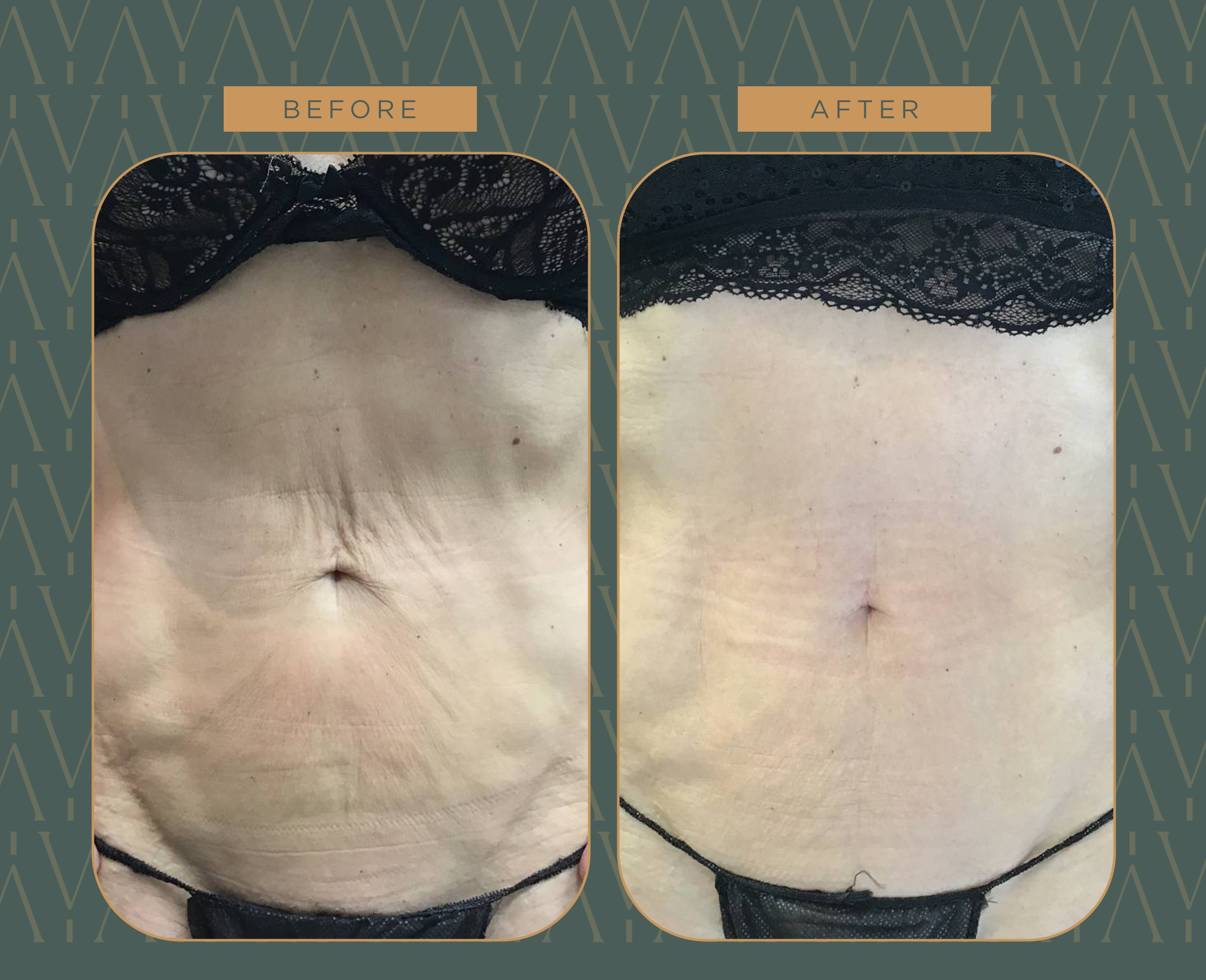 1 copia - 2024-10-25T110426.885