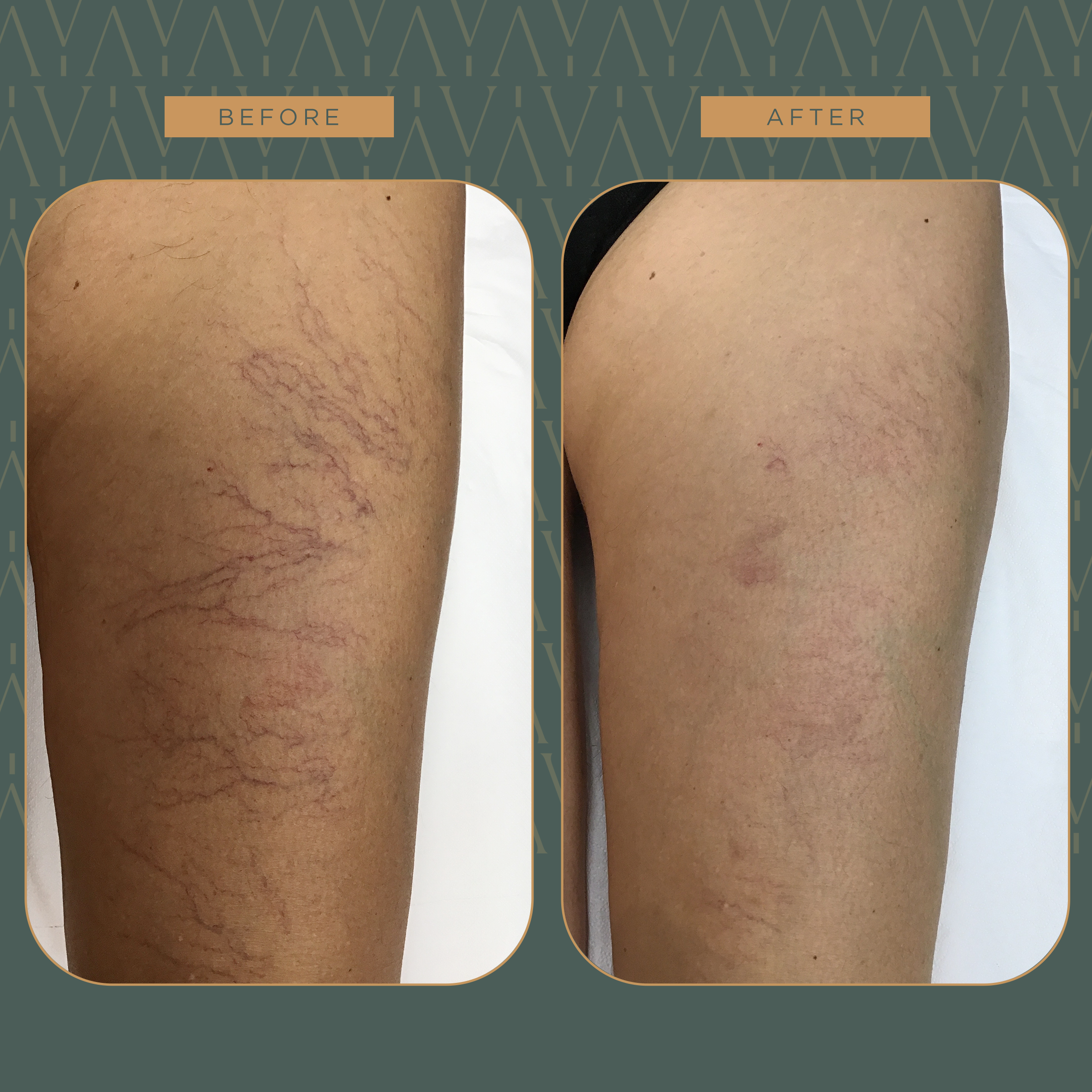 Capillari2 copia (1)