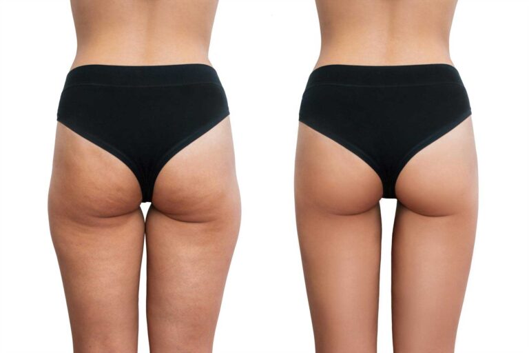 Culotte de Cheval